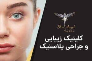 کلینک زیبایی بلو انجل